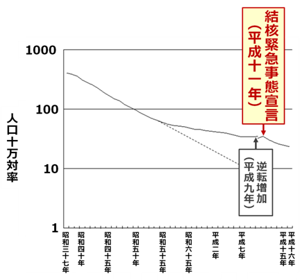 結核 結核は過去の病気ではありません 2週間以上咳や微熱が続く場合は病院を受診しましょう ウェルネスセンターコラム Sbアットワーク株式会社