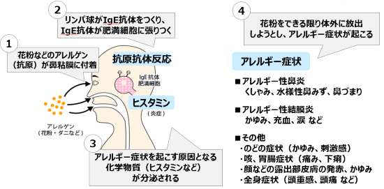 花粉症 アレルギー 突然発症することもあるので要注意 ウェルネスセンターコラム Sbアットワーク株式会社